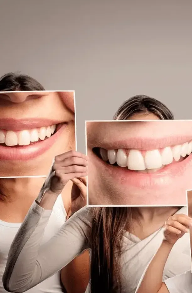 Dental Treatment